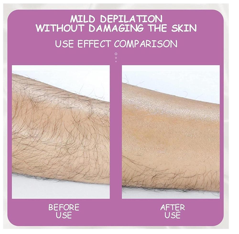 Painless Hair Revover Epilator